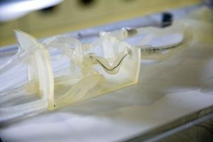Распечатанная на 3D-принтере модель системы сосудов мозга пациента